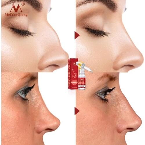 Fashion Nose Beautiful Essential Oil Shaping a beautiful nose Care Remodeling oil Lift Magic Essence Cream 10ml