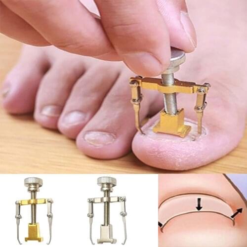 Ingrown Toenail Toe Fixer Recover Correction Device Pedicure Foot Nail Care Tool Straightening Clip Brace corrector Wire Fixer