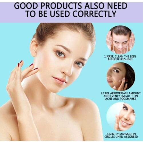 Effective Acne Removal Cream Acne Treatment Fade Spots Moisturizing Skin Shrink Oil Care Acne Control Whitening Pores Cream R0W0