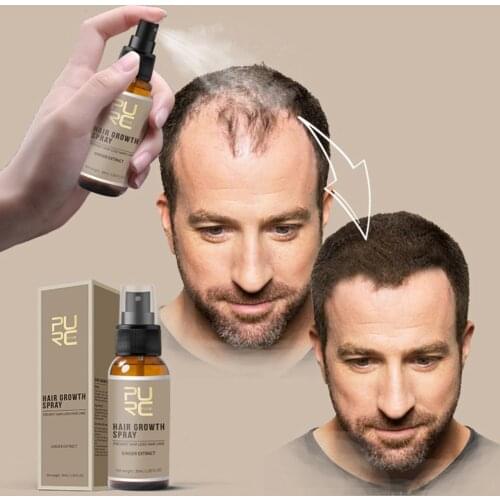 2019 New 30ml Hair Growth Spray Ginger Essence Spray Effective Extract Anti Hair Loss Nourish Roots Regrowth Treatment Liquid