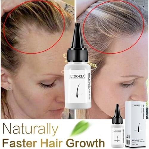Hair Loss Goods Natural with No Side Effects Grow Hair Faster Regrowth Hair Eye Lashes Serum Mascara Lengthening Eyebrow Growth