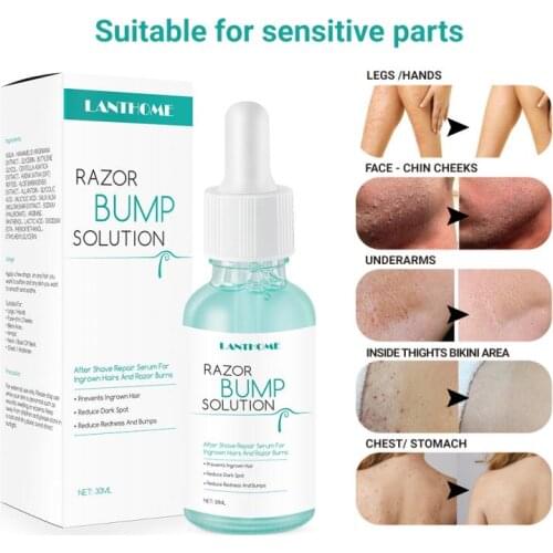 30ml Razor Bumps Solution For Ingrown Hair Inhibitor Hair Remover And Growth Inhibitor TSLM1