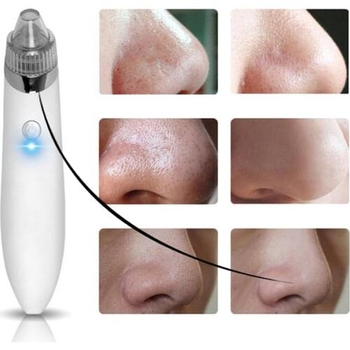 Facial Blackhead Remover Vacuum Dead Skin Acne Pore Peeling Device Cleaning Skin Tool Suck Out Blackhead Beauty Machine Plug-in