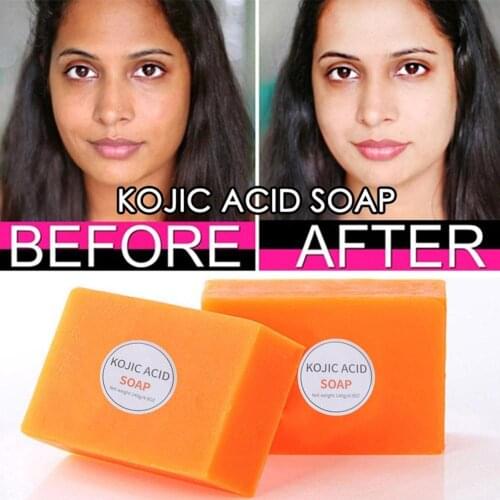Dark Black Skin Lightening Soap Kojic Acid Whitening Soap Kojic Acid Glycerin Brighten Face Body Skin Bleaching Soap