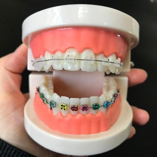 Dental Orthodontic Treatment Model Typodont With Ortho Metal Ceramic Bracket Arch Wire Buccal Tube Ligature Ties