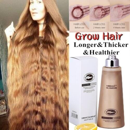 Crocodile Hair Growth Shampoo Anti Hair Loss Treatment Fast Growth Longer thicker for Men Women Best Hair Growth Products 200ml