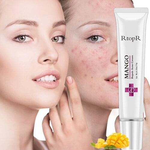 Acne-Treatment Cream Blackhead Repair Gel Oil-Control Shrink Pores Acne Scar Whitening Moisturizing Cream Korean Cosmetics
