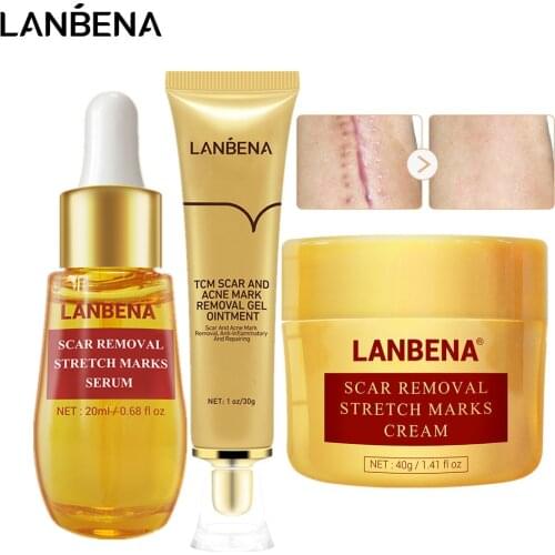LANBENA Skin Scar Treatment Sets Repairing Cream Scar Remove Serum Stretch Essence Acne Marks Face Care Kit 3Pcs/set