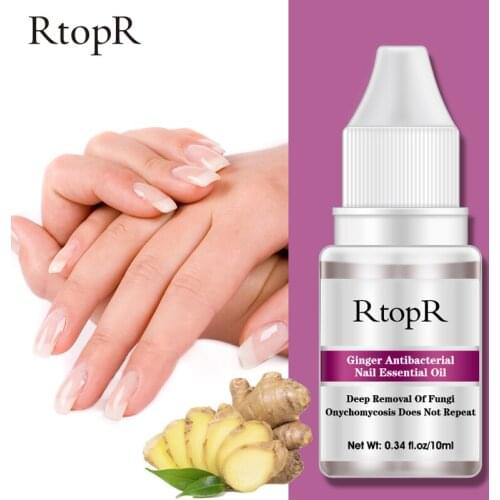 RtopR Treatment Foot Nail Fungus Removal Serum Ginger Antibacterial Nail Essential Oil Anti Infection Paronychia Onychomycosis