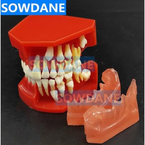 Dental Children Deciduous Teeth Model Replacement Model Permanent Teeth Alternate Display Removable Demonstration for Teaching