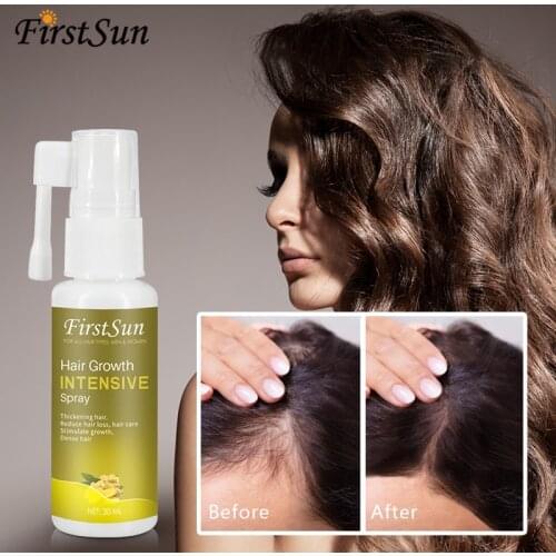 Firstsun 30ml Hair Essence Ginger Spray Moisturizing Hair Growth Anti Hair Loss Treatment Nourishing Strengthen hair Care TSLM1