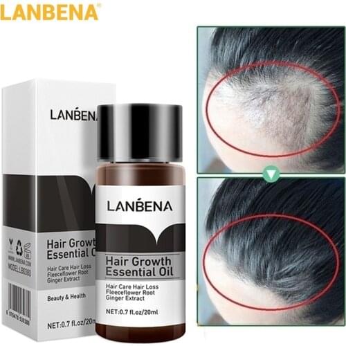 LANBENA 20ml Ginger Hair Growth Essence Nutrient Solution Preventing Hair Loss Treatment Hair Care Essential Oil for Men Women