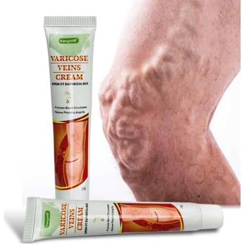 20g Varicose Veins Ointmnet Vasculitis Phlebitis Spider Cream Varicosity Angiitis Inflammation Removal Herbal Medical Plaster