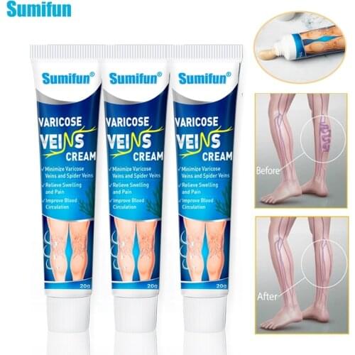 3pcs Varicose Veins Treatment Vasculitis Phlebitis Spider Cream Phlebitis Spider Leg Varicosity Angiitis Removal Medical Patch