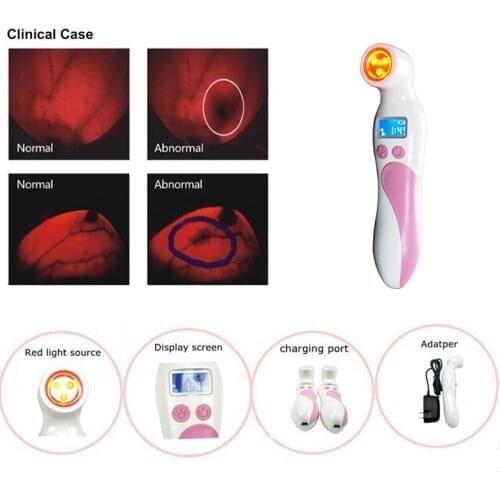 Testing for mastitis infrared breast diagnostic instrument 625 nm red
