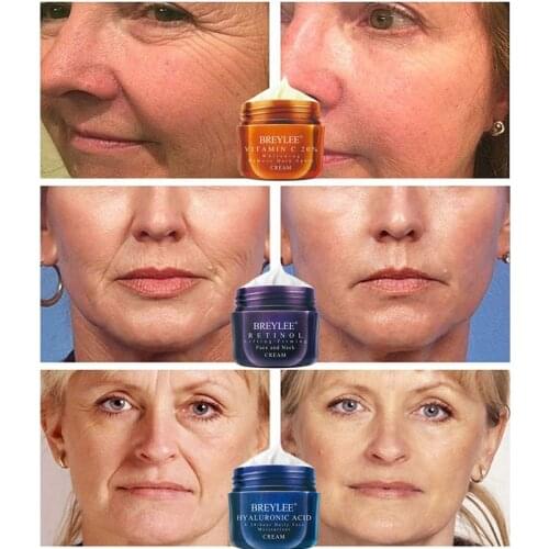 BREYLEE Retinol Firming Face Cream Lifting Neck Anti-Aging Removing Wrinkles Night Day Moisturizer Whitening Face Skin Care 40g