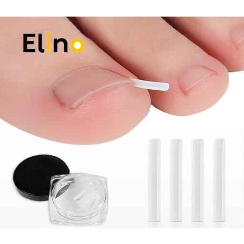 Ingrown Nail Pad Toenail Correction Treatments Sticker Corrector Straightening Clip Brace Groove Orthopedic Foot Care Tools