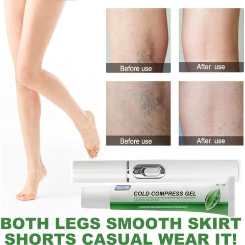 1 Set Varicose Legs Cold Compress Gel Medicine Ointment For Women Veins Cream Herbal Care Treatment Body Varicose Gel Suit 20g