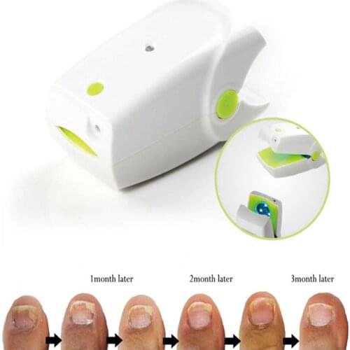 Highly Effective Rechargeable Nail Fungus Laser Treatment Device Nail Infection Onychomycosis Cure Nail Fungal Infections