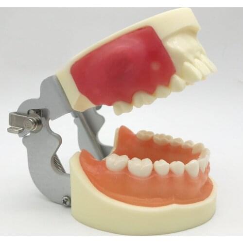 Dental Oral Cavity Teaching Model Abscess Incision Drainage Tooth Model