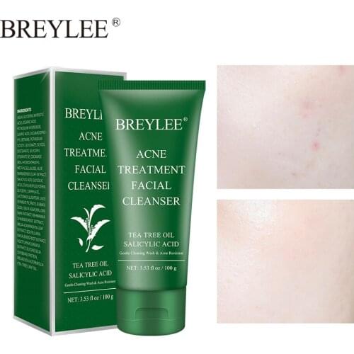BREYLEE Facial Acne Treatment Cleanser Remove Blackhead Cleaner Shrink Pore Oil Control Cleansing Wash Face Skin Care 100g