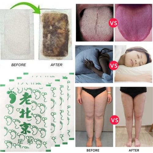 100 Pcs Detox Loss Weight Foot Patch Improve Sleep Old Beijing Bamboo Vinegar Foot Patch Anti-Swelling Revitalizing Health Care