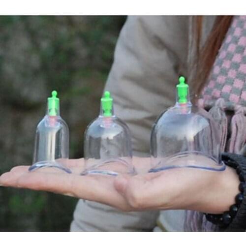 Chinese cupping Kangzhu U Curved Vacuum Cupping Suction Joint 3 cup cupping therapy joints cups Traditional Acupuncture Massage