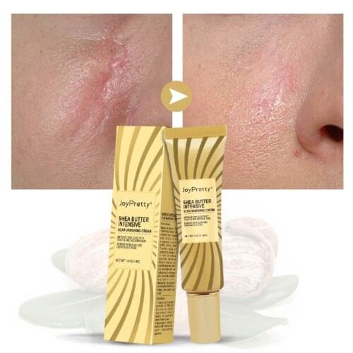 JoyPretty Repair Scar Cream Removal Acne Scars Stretch Marks Cream Surgical Scar Burn For Body Pigmentation Corrector Care Gel