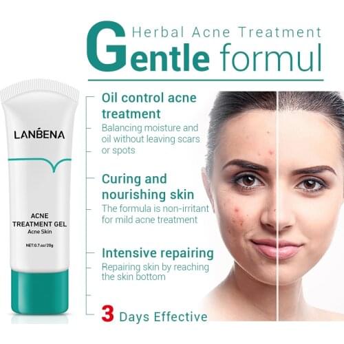 LANBENA Acne Treatment Face Cream Blackhead Removal Damage Fade Marks Repair Acne Scars Gel Shrink Pores Whitening Skin Care 20g