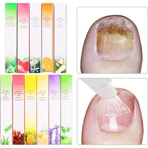 Nail Nutrition Oil Pen Nail Treatment Revitalizer Cuticle Oil Pen Softener Pen Nail Care Treatment Nail Products (Random) TSLM2