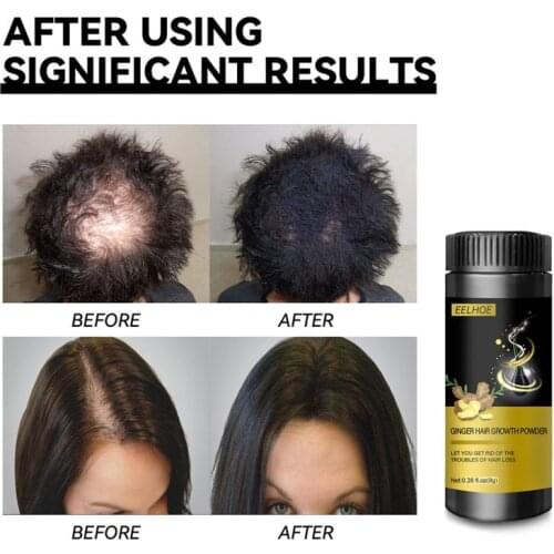 Natural Ginger Hair Growth Essences Instantly Black Root Hair Fluffy Powder Hair Loss Hairline Repair Hair Fibers Styling Tool