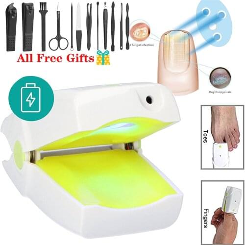 905nm Cold Fungal Nail Treatment Laser Nail Fungal Onychomycosis Paronychia Anti-Fungal Lnfection Grey Toenail Laser Device