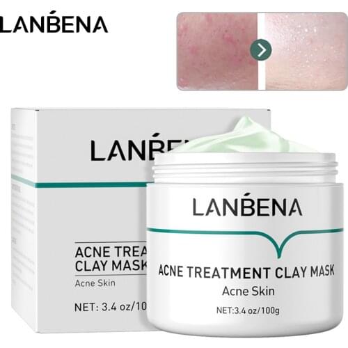 LANBENA Acne Treatment Clay Mask Oligopeptide Acne Masks Mud Face Cream Grease Cleansing Firming Pore Remove Oil Serum Skin Care