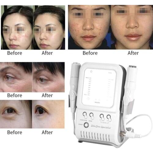 New Useful 2In1 RF No-Needle Massager Quality ABS Skin Face Lift Firming Radio Frequency Facial Skin Rejuvenation Beauty Machine