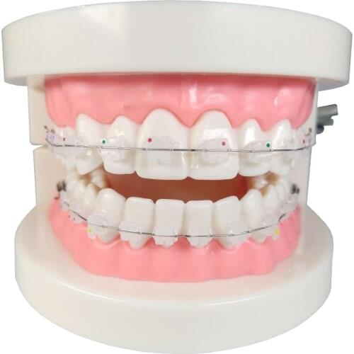 1 Piece Dental Orthodontic Teeth Model Ceramic Brackets with Adelomorphic Ligature Tie Buccal Tube NiTi Archwire