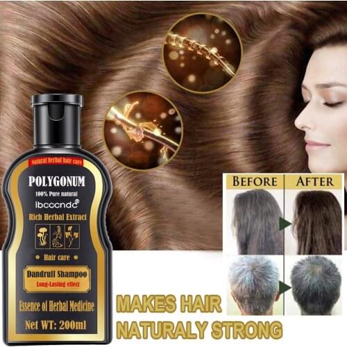 Hair Shampoo Hair Darkening Permanent Black Color Anti Gray Hair Treatment White Removal Natural Black Hair Health Shampoo