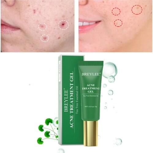 BREYLEE Acne Treatment Face Serum Pimple Acne Removal Gel Enhanced Acne Repairing Anti Inflammation Oil Control Acne Skin Care