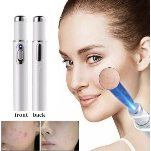 Blue Light Therapy Varicose Veins Treatment Laser Pen Soft Scar Wrinkle Removal Treatment Acne Laser Pen Heath Massage Relax