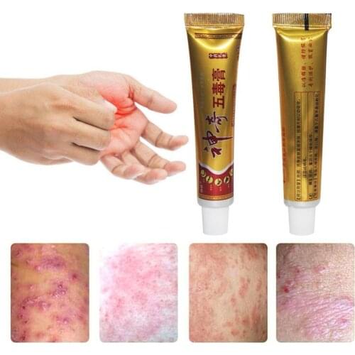 3Pcs Eczema Ointment Treatment Psoriasis Cream New Skin Herbal Psoriasis Pruritus Cream Dermatitis Eczematoid yiganerjing