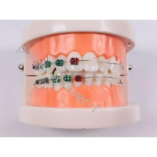 1 Piece Dental Othodontic Ceramic Metal Brackets Brace Contast Typodont Elastics