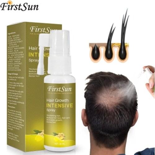 Hair Care Essential Oil Essence Preventing Hair Loss Moisturizing Nourishing for Women Men SSwell