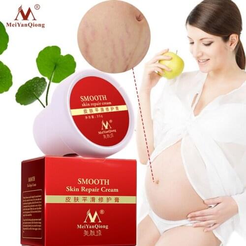 Skin Smooth Repair Cream Remove Stretch Marks Treatment Maternity Repair Anti-Aging Anti-Wrinkles Firming Stretch Mark