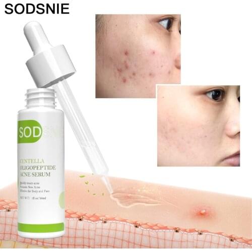 Moisturizing Face Serums SODSNIE China