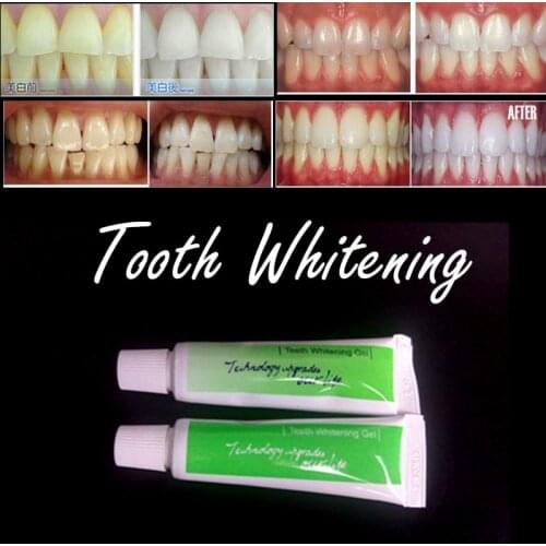 2pcs Tanden Dentist Teeth Tooth Fast Whitening Gel for Dental Oral Hygiene Care Yellow Teeth Treatment Lab Tool