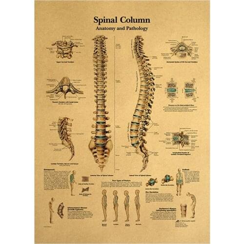 Retro Human Body Structure Diagram Back Spine Nerve Structure Diagram Poster Home Decor Kraft Paper Wall Sticker 42x30cm