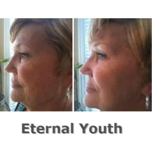 1KG 1L Hyaluronic Acid AGELESS HA Anti Aging Wrinkles Fine Line Skin Care Equipment Beauty Salon Products 1000ML