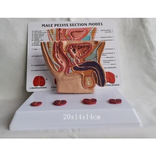 Human Male pelvis section Abdominal Cavity Bladder Prostate Medical Teaching Model Health Illness Comparison Anatomical Model