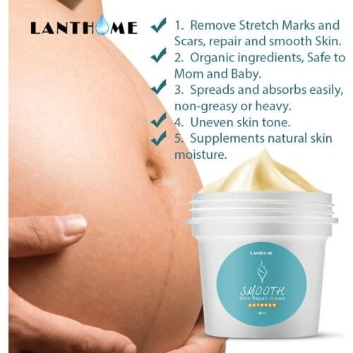3PCS Smooth Skin Repair Cream for Anti Stretch Marks Pregnancy Scar Remover Cream Acne Scar Removal Cream Maternity Treatment