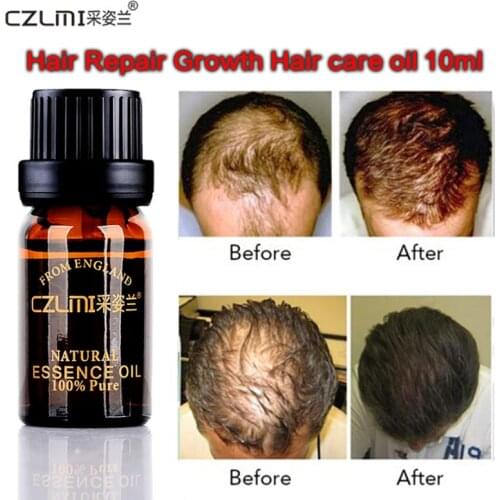 Hair Care Fast Powerful Hair Growth Products Regrowth Essence Liquid Treatment Preventing Hair Loss for Men Women 10ml Oil