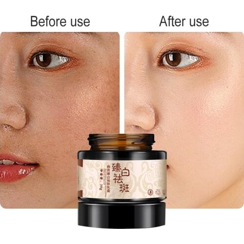 Whitening Freckle Cream Chinese Herbal Plant Face Cream Remove Freckles And Dark Spots Skin Whitening Cream Face Care TSLM1
